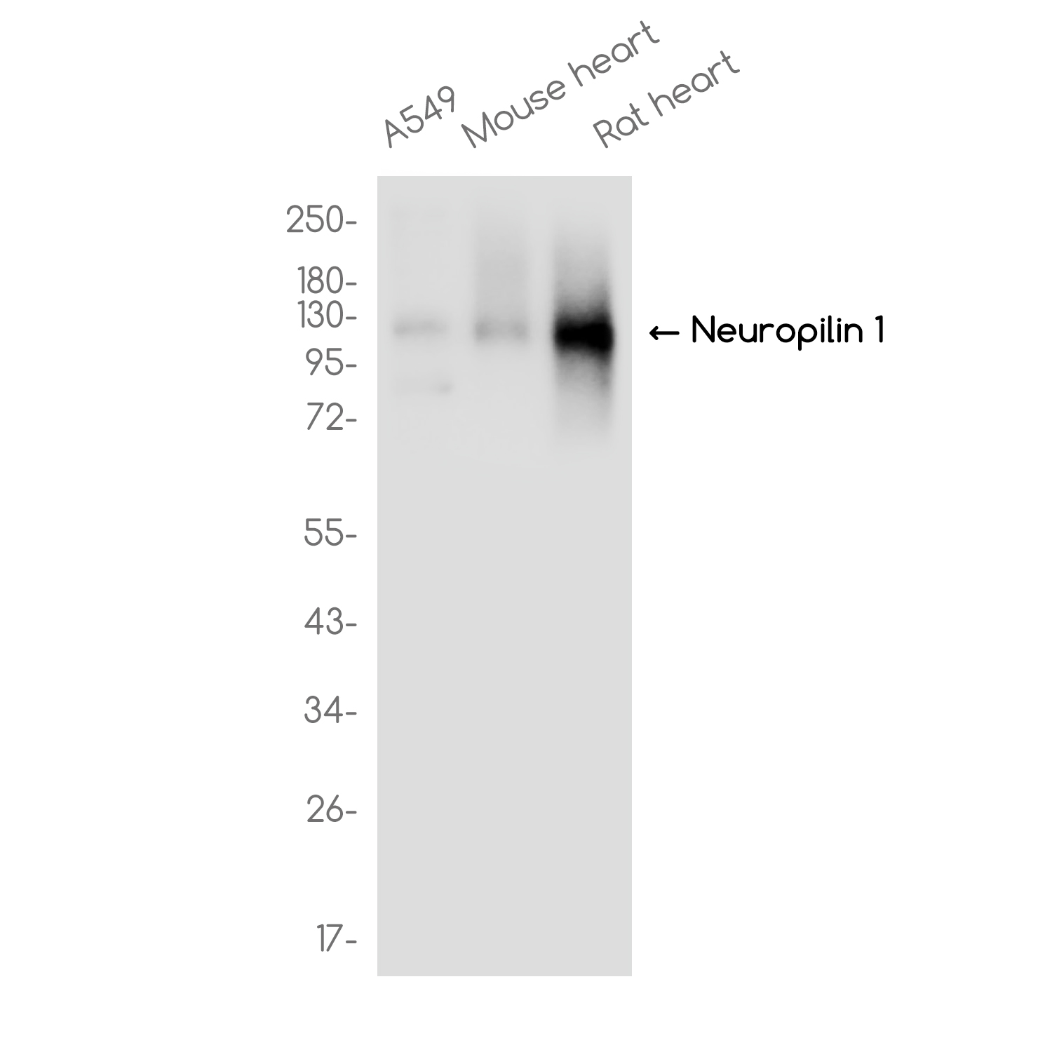 Neuropilin 1 Rabbit mAb
